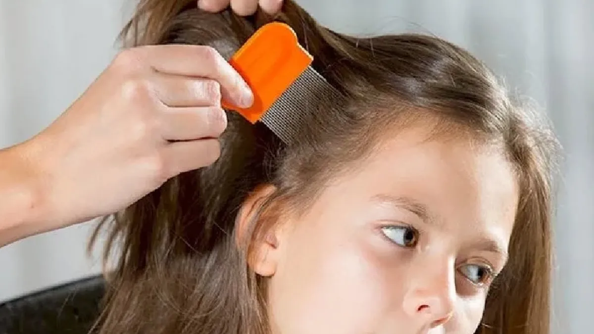 Bit Zıplar Mı? Bitler Zıplayabilir Mi, Uçar Mı, Kanatları Var Mı?