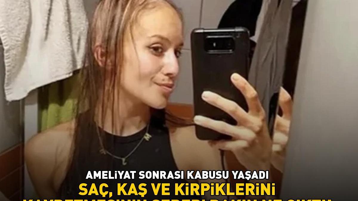 Güzelleşmek için bıçak altına yattı, ameliyat sonrası kabusu yaşadı! Saç, kaş ve kirpiklerini kaybetmesinin sebebi bakın ne çıktı!